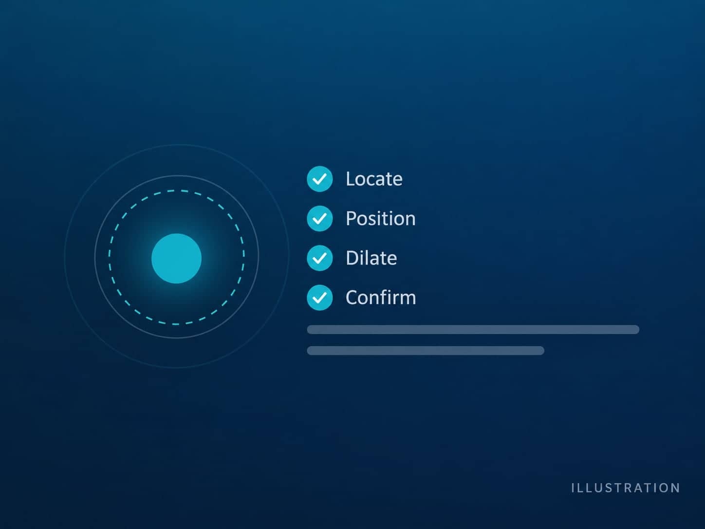 Concept illustration of future software: a live-view indicator beside steps Locate, Position, Dilate and Confirm